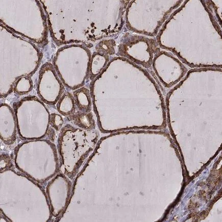 Immunohistochemistry (Formalin/PFA-fixed paraffin-embedded sections) - Anti-ERp57 antibody [CL2444] (AB242367)