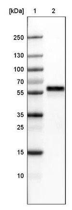 Western blot - Anti-ERp57 antibody [CL2444] (AB242367)