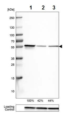 Western blot - Anti-ERp57 antibody [CL2444] (AB242367)