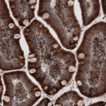 Immunohistochemistry (Formalin/PFA-fixed paraffin-embedded sections) - Anti-ERp57 antibody [CL2452] (AB242362)