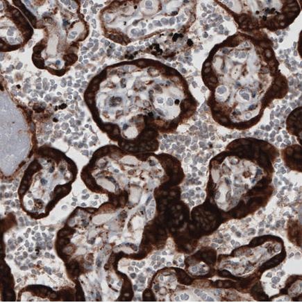 Immunohistochemistry (Formalin/PFA-fixed paraffin-embedded sections) - Anti-ERp57 antibody [CL2452] (AB242362)