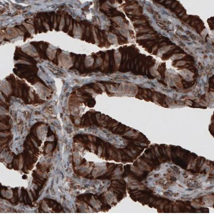 Immunohistochemistry (Formalin/PFA-fixed paraffin-embedded sections) - Anti-ERp57 antibody [CL2452] (AB242362)