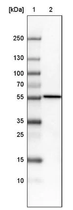 Western blot - Anti-ERp57 antibody [CL2452] (AB242362)