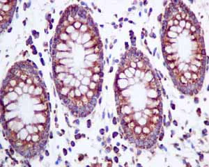 Immunohistochemistry (Formalin/PFA-fixed paraffin-embedded sections) - Anti-ERp57 antibody [EPR10678(B)] (AB154191)