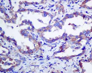 Immunohistochemistry (Formalin/PFA-fixed paraffin-embedded sections) - Anti-ERp57 antibody [EPR10678(B)] (AB154191)