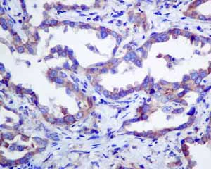 Immunohistochemistry (Formalin/PFA-fixed paraffin-embedded sections) - Anti-ERp57 antibody [EPR10678(B)] - BSA and Azide free (AB249088)