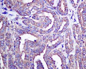 Immunohistochemistry (Formalin/PFA-fixed paraffin-embedded sections) - Anti-ERp57 antibody [EPR10678(B)] - BSA and Azide free (AB249088)