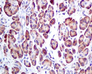 Immunohistochemistry (Formalin/PFA-fixed paraffin-embedded sections) - Anti-ERp57 antibody [EPR10679(B)] (AB154197)