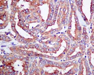 Immunohistochemistry (Formalin/PFA-fixed paraffin-embedded sections) - Anti-ERp57 antibody [EPR10679(B)] (AB154197)