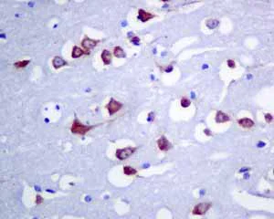 Immunohistochemistry (Formalin/PFA-fixed paraffin-embedded sections) - Anti-ERp57 antibody [EPR10679(B)] (AB154197)