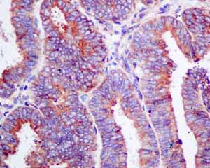 Immunohistochemistry (Formalin/PFA-fixed paraffin-embedded sections) - Anti-ERp57 antibody [EPR10679(B)] (AB154197)