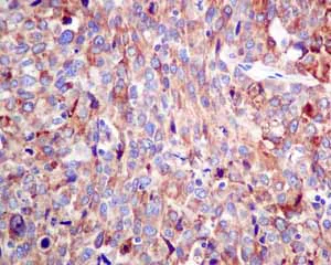 Immunohistochemistry (Formalin/PFA-fixed paraffin-embedded sections) - Anti-ERp57 antibody [EPR10679(B)] (AB154197)