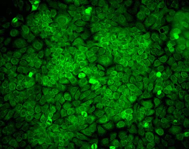 Immunocytochemistry/ Immunofluorescence - Anti-ERp57 antibody [MaP.Erp57] (AB13506)