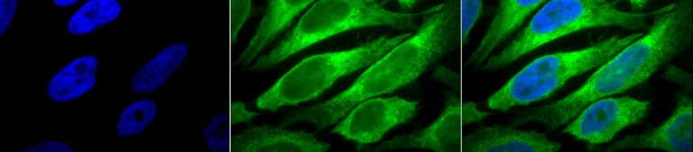 Immunocytochemistry/ Immunofluorescence - Anti-ERp57 antibody [MaP.Erp57] (AB13506)