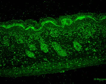 Immunohistochemistry (Formalin/PFA-fixed paraffin-embedded sections) - Anti-ERp57 antibody [MaP.Erp57] (AB13506)