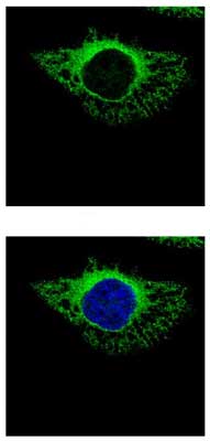Immunocytochemistry/ Immunofluorescence - Anti-ERp72 antibody (AB155800), expandable thumbnail