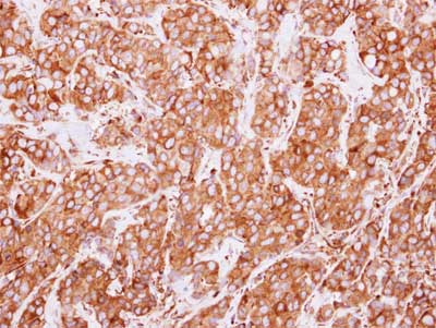Immunohistochemistry (Formalin/PFA-fixed paraffin-embedded sections) - Anti-ERp72 antibody (AB155800), expandable thumbnail