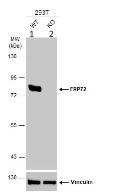 Western blot - Anti-ERp72 antibody (AB155800)
