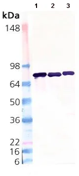 Western blot - Anti-ERp72 antibody (AB82587)