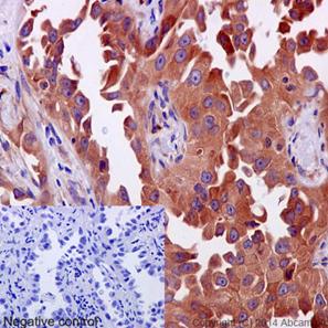 Immunohistochemistry (Formalin/PFA-fixed paraffin-embedded sections) - Anti-ERp72 antibody [EPR14824(B)] - BSA and Azide free (AB251013), expandable thumbnail
