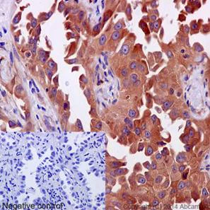 Immunohistochemistry (Formalin/PFA-fixed paraffin-embedded sections) - Anti-ERp72 antibody [EPR14824(B)] - BSA and Azide free (AB251013)