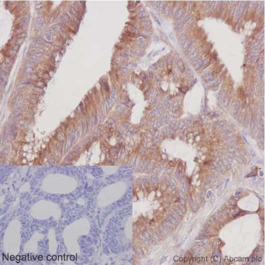 Immunohistochemistry (Formalin/PFA-fixed paraffin-embedded sections) - Anti-ERp72 antibody [EPR14825] - BSA and Azide free (AB251017)