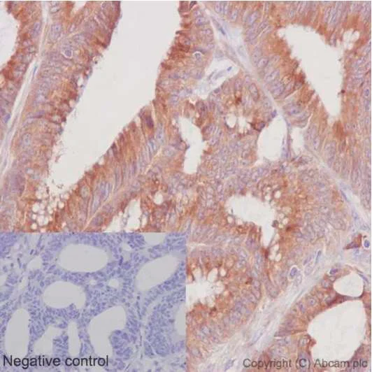 Immunohistochemistry (Formalin/PFA-fixed paraffin-embedded sections) - Anti-ERp72 antibody [EPR14825] - BSA and Azide free (AB251017)
