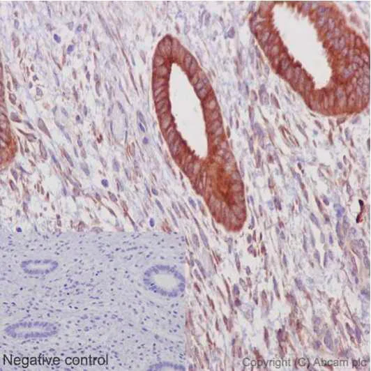 Immunohistochemistry (Formalin/PFA-fixed paraffin-embedded sections) - Anti-ERp72 antibody [EPR14825] - BSA and Azide free (AB251017)