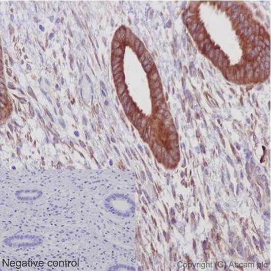 Immunohistochemistry (Formalin/PFA-fixed paraffin-embedded sections) - Anti-ERp72 antibody [EPR14825] - C-terminal (AB190354)