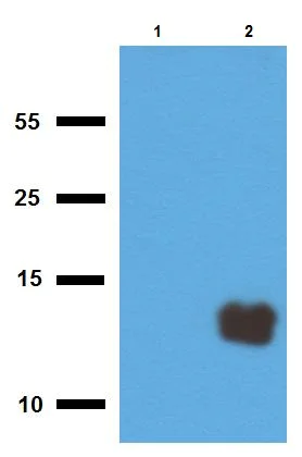Western blot - Anti-ESAT-6-like protein EsxR antibody (AB231193)