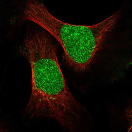 Immunocytochemistry/ Immunofluorescence - Anti-ESCO2 antibody (AB219996)