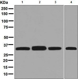 Western blot - Anti-ESD antibody [EPR8447] (AB133631)