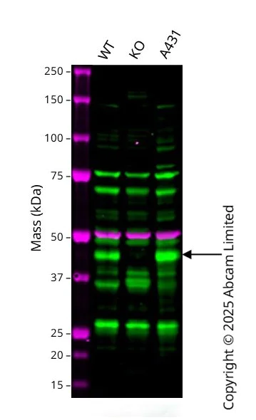 Western blot - Anti-ESE1 antibody [EPESER1] - BSA and Azide free (AB248579)