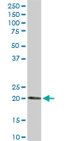Western blot - Anti-ESM1 antibody (AB103590)