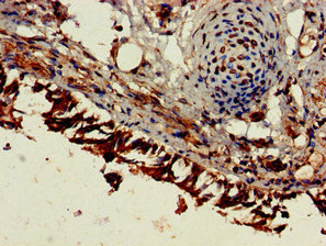Immunohistochemistry (Formalin/PFA-fixed paraffin-embedded sections) - Anti-ESM1 antibody (AB224591)