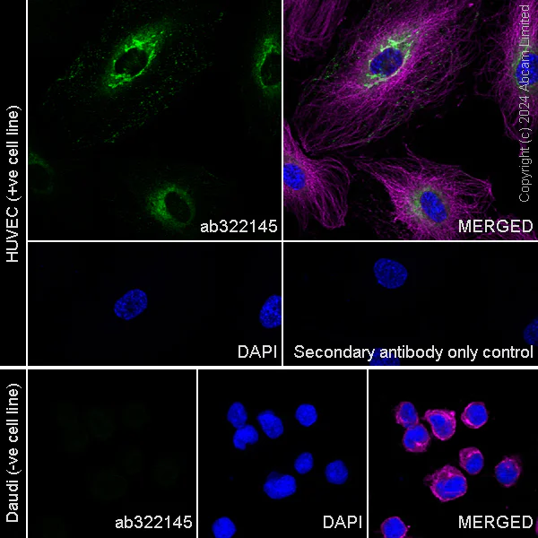 Immunocytochemistry/ Immunofluorescence - Anti-ESM1 antibody [EPR29619-546] - BSA and Azide free (AB324768)