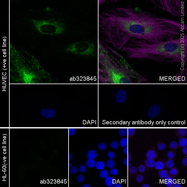 Immunocytochemistry/ Immunofluorescence - Anti-ESM1 antibody [RM1338] (AB323845)