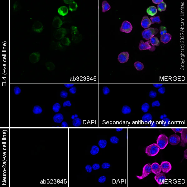 Immunocytochemistry/ Immunofluorescence - Anti-ESM1 antibody [RM1338] (AB323845)