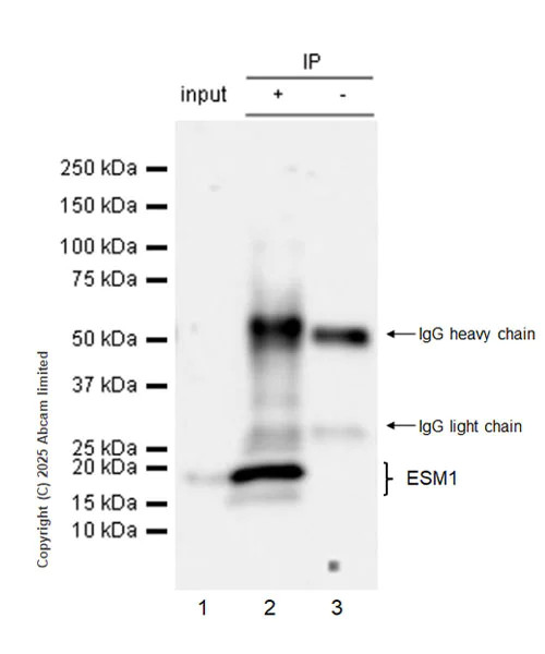 Immunoprecipitation - Anti-ESM1 antibody [RM1338] (AB323845)