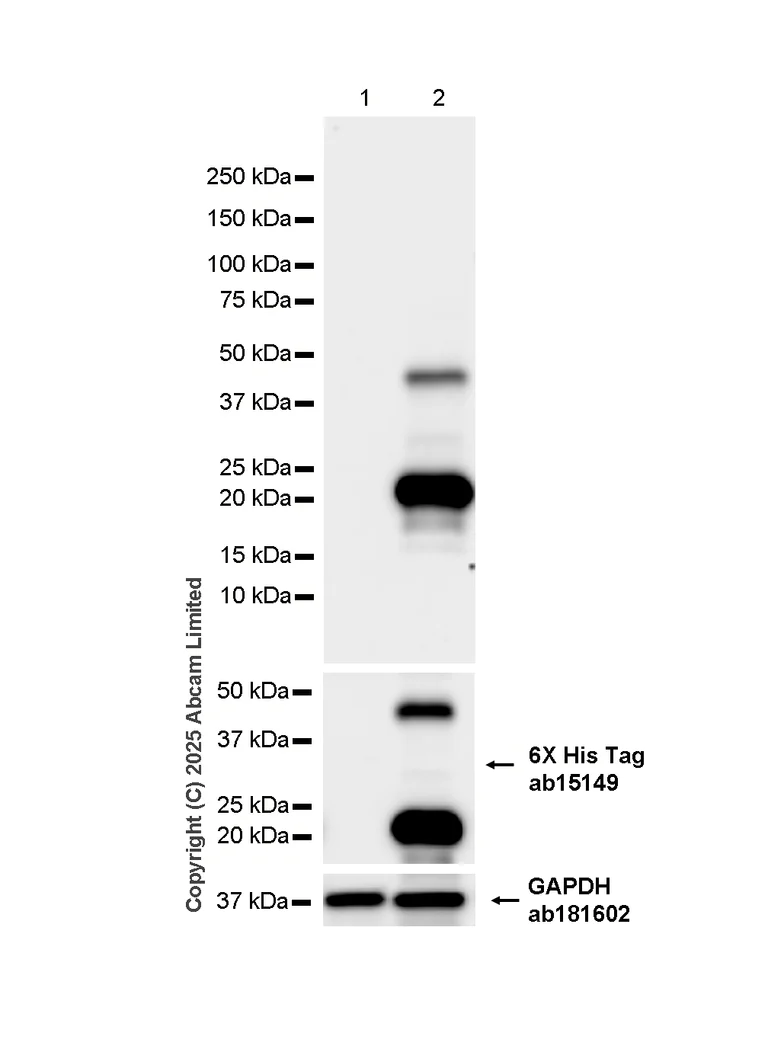 Western blot - Anti-ESM1 antibody [RM1338] (AB323845)