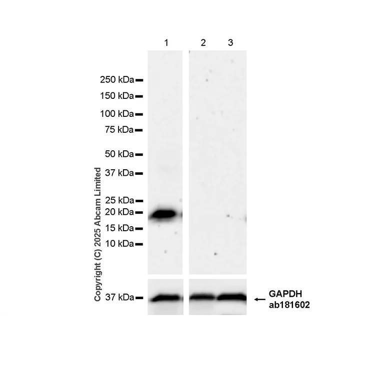 Western blot - Anti-ESM1 antibody [RM1338] (AB323845)