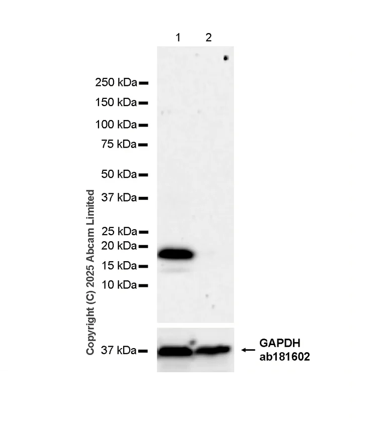 Western blot - Anti-ESM1 antibody [RM1338] (AB323845)