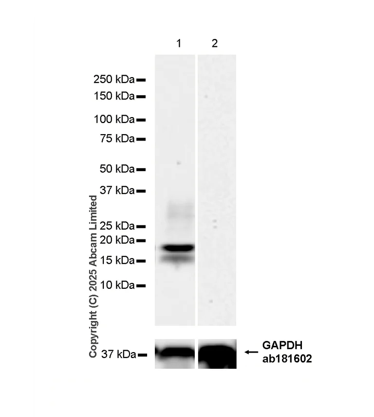 Western blot - Anti-ESM1 antibody [RM1338] (AB323845)