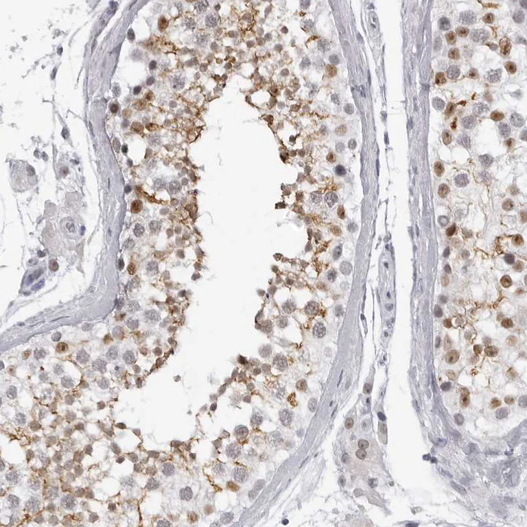 Immunohistochemistry (Formalin/PFA-fixed paraffin-embedded sections) - Anti-Espin antibody (AB254774)