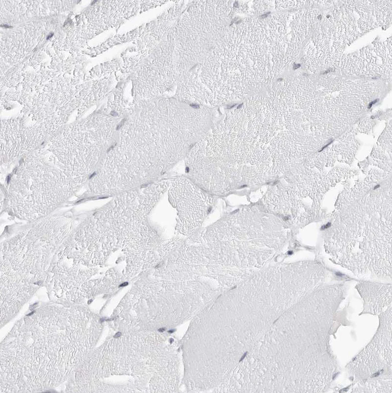 Immunohistochemistry (Formalin/PFA-fixed paraffin-embedded sections) - Anti-Espin antibody (AB254774)