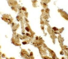Immunohistochemistry (Formalin/PFA-fixed paraffin-embedded sections) - Anti-ESRP2 antibody (AB113486)