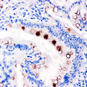Immunohistochemistry (Formalin/PFA-fixed paraffin-embedded sections) - Anti-Estrogen Inducible Protein pS2 antibody (AB190942)