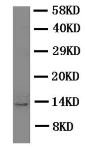Western blot - Anti-Estrogen Inducible Protein pS2 antibody (AB190942)