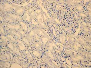 Immunohistochemistry (Formalin/PFA-fixed paraffin-embedded sections) - Anti-Estrogen Inducible Protein pS2 antibody [EPR3972] (AB92377)