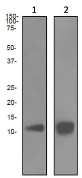 Western blot - Anti-Estrogen Inducible Protein pS2 antibody [EPR3972] (AB92377)